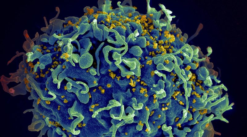 UN says nearly 40 million people had HIV in 2023, lack of treatment means someone died every minute