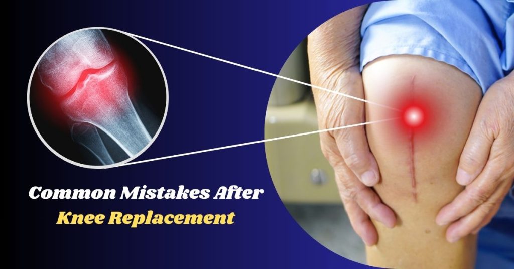 Top 5 Mistakes After Knee Replacement and How to Avoid Them 2 Top 5 Mistakes After Knee Replacement