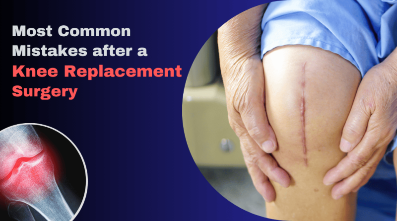 Top 5 Mistakes After Knee Replacement and How to Avoid Them